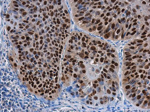 SOX2 Antibody in Immunohistochemistry (Paraffin) (IHC (P))