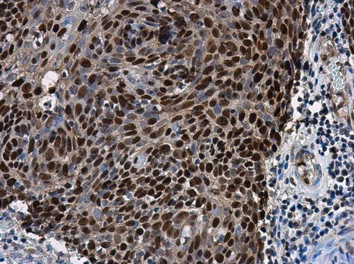 SOX2 Antibody in Immunohistochemistry (Paraffin) (IHC (P))