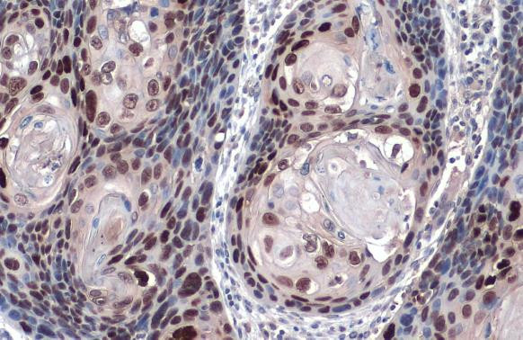 SOX2 Antibody in Immunohistochemistry (Paraffin) (IHC (P))