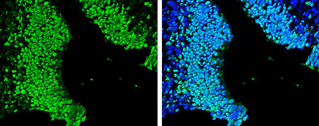 SOX2 Antibody in Immunohistochemistry (Paraffin) (IHC (P))