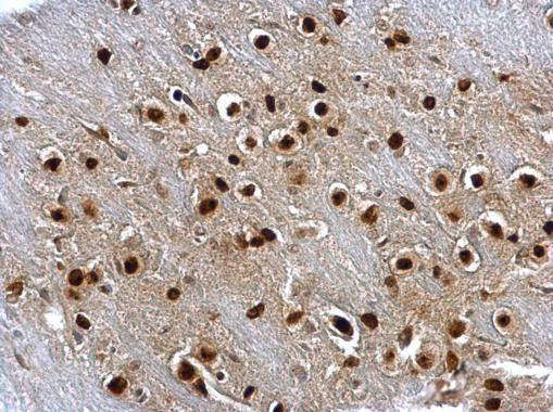 SOX2 Antibody in Immunohistochemistry (Paraffin) (IHC (P))