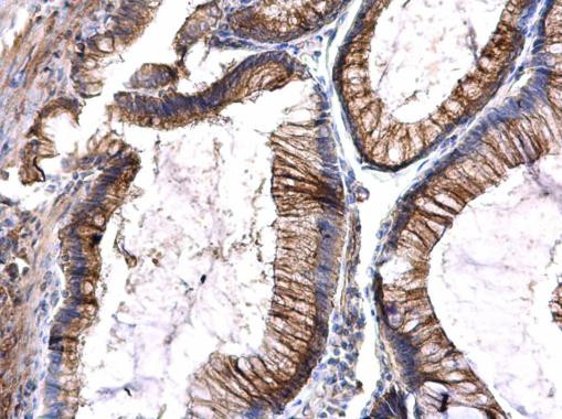 FLT3 Antibody in Immunohistochemistry (Paraffin) (IHC (P))