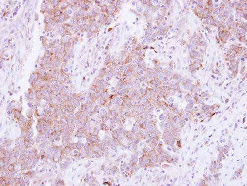 CD81 Antibody in Immunohistochemistry (Paraffin) (IHC (P))