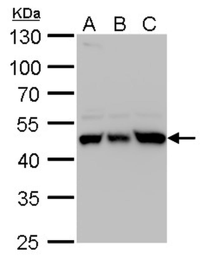 UQCRC1 Antibody in Western Blot (WB)