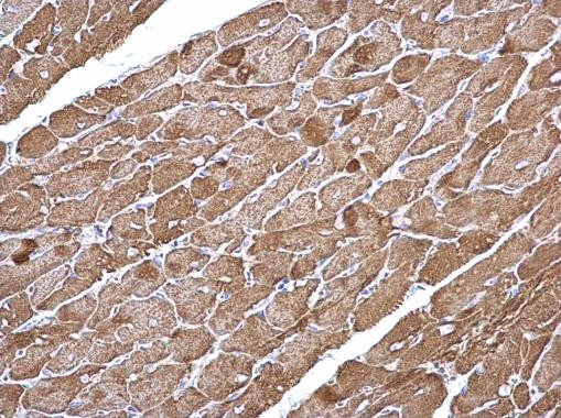 alpha-Cardiac Actin Antibody in Immunohistochemistry (Paraffin) (IHC (P))