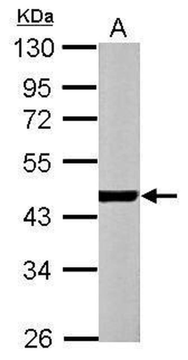 alpha-Cardiac Actin Antibody in Western Blot (WB)