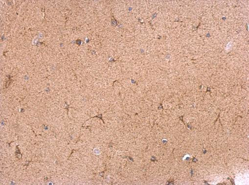 VAMP1 Antibody in Immunohistochemistry (Paraffin) (IHC (P))