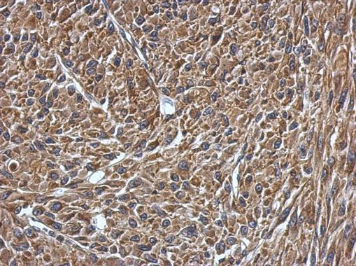 VAMP1 Antibody in Immunohistochemistry (Paraffin) (IHC (P))