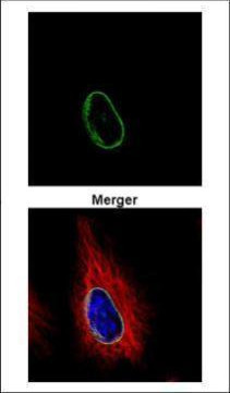 POM121 Antibody in Immunocytochemistry (ICC/IF)