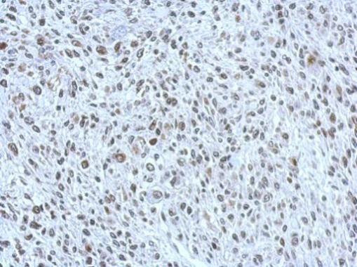 POM121 Antibody in Immunohistochemistry (Paraffin) (IHC (P))