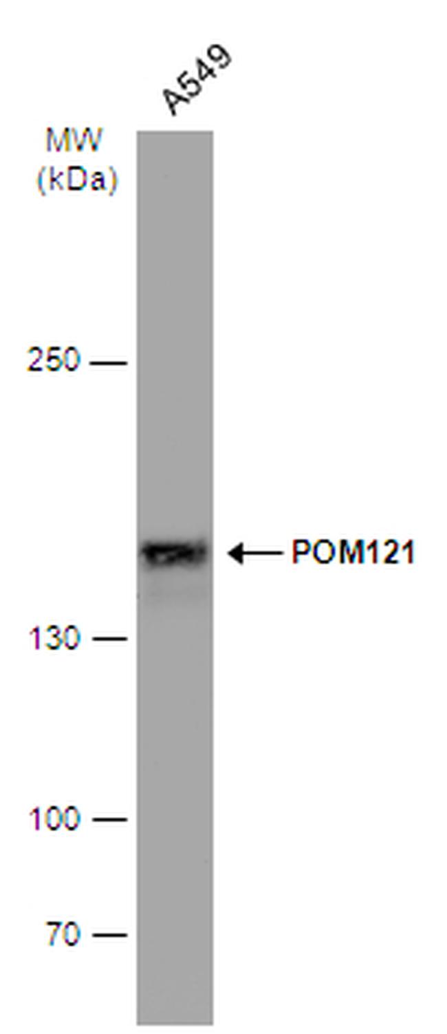 POM121 Antibody in Western Blot (WB)