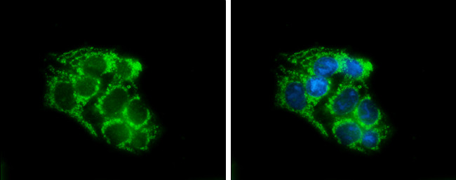 SLC25A1 Antibody in Immunocytochemistry (ICC/IF)