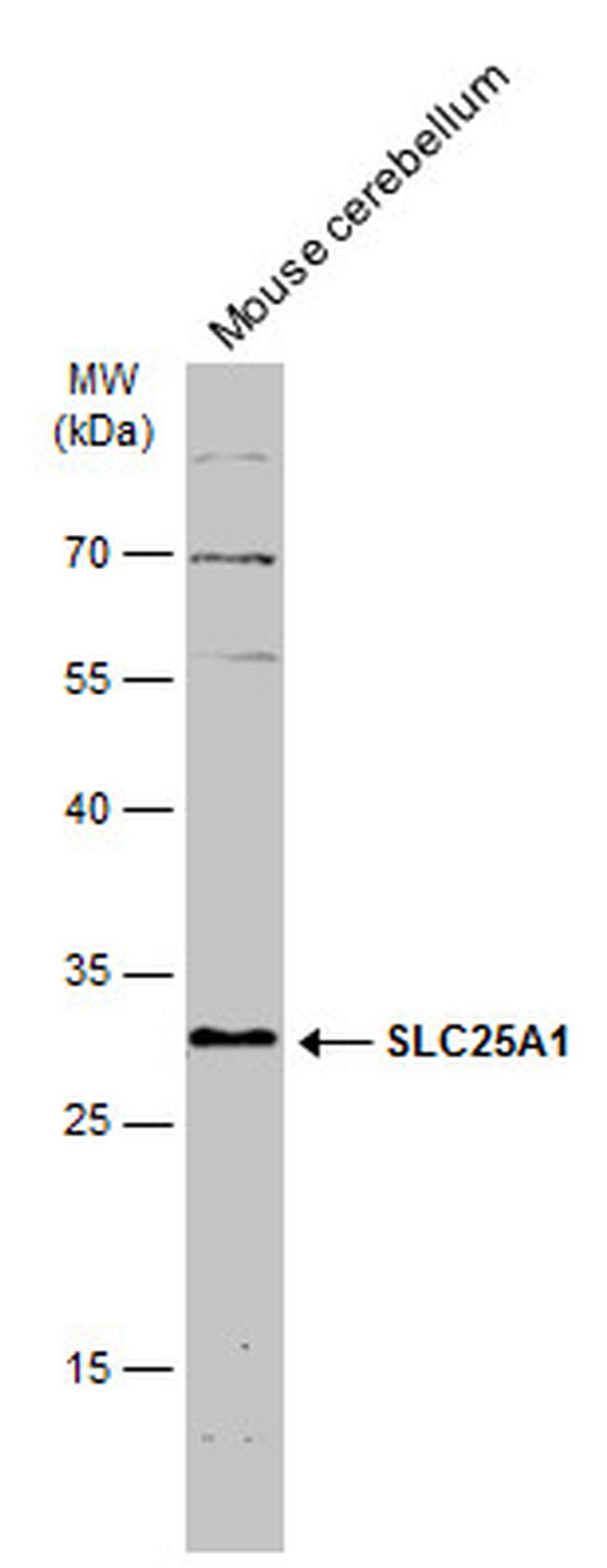 SLC25A1 Antibody in Western Blot (WB)