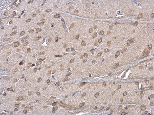 ERP29 Antibody in Immunohistochemistry (Paraffin) (IHC (P))