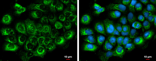 Albumin Antibody in Immunocytochemistry (ICC/IF)