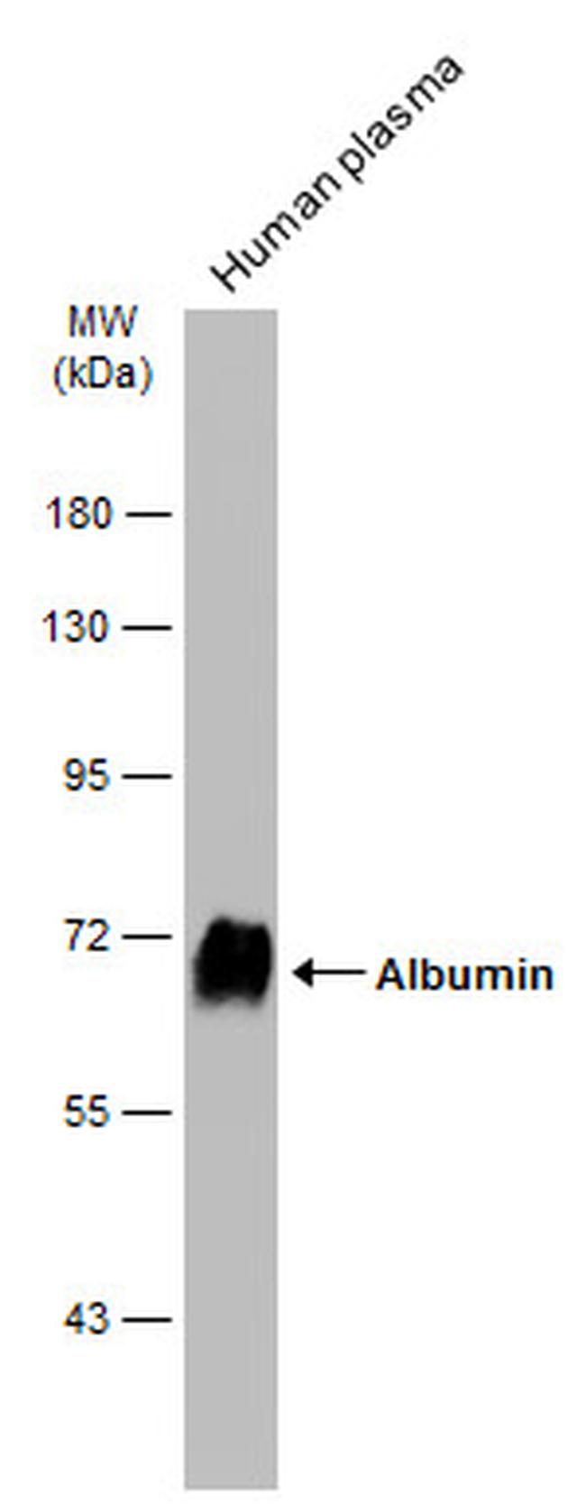 Albumin Antibody in Western Blot (WB)