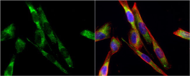 Tyrosine Hydroxylase Antibody in Immunocytochemistry (ICC/IF)