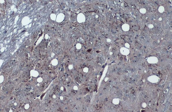 Tyrosine Hydroxylase Antibody in Immunohistochemistry (Paraffin) (IHC (P))