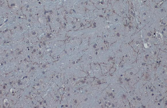 Tyrosine Hydroxylase Antibody in Immunohistochemistry (Paraffin) (IHC (P))