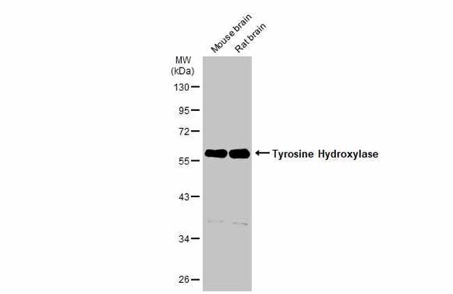 Tyrosine Hydroxylase Antibody in Western Blot (WB)