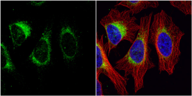 Tyrosine Hydroxylase Antibody in Immunocytochemistry (ICC/IF)