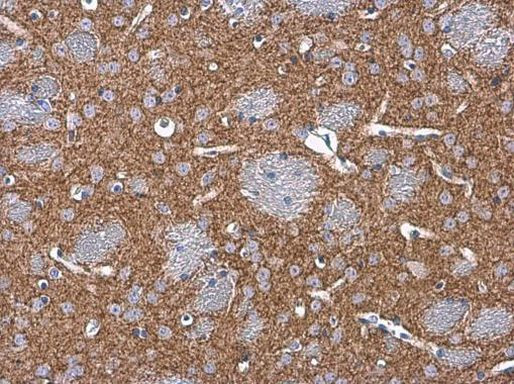 Tyrosine Hydroxylase Antibody in Immunohistochemistry (Paraffin) (IHC (P))