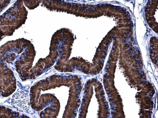 GRP78 Antibody in Immunohistochemistry (Paraffin) (IHC (P))