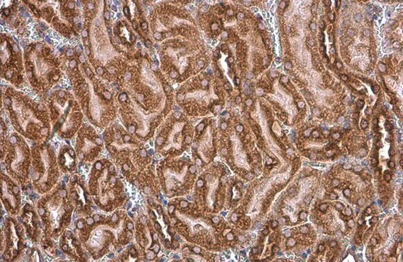 GRP78 Antibody in Immunohistochemistry (Paraffin) (IHC (P))