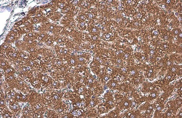 GRP78 Antibody in Immunohistochemistry (Paraffin) (IHC (P))