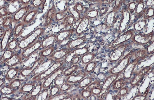 GRP78 Antibody in Immunohistochemistry (Paraffin) (IHC (P))