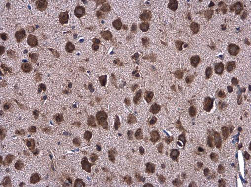 GRP78 Antibody in Immunohistochemistry (Paraffin) (IHC (P))