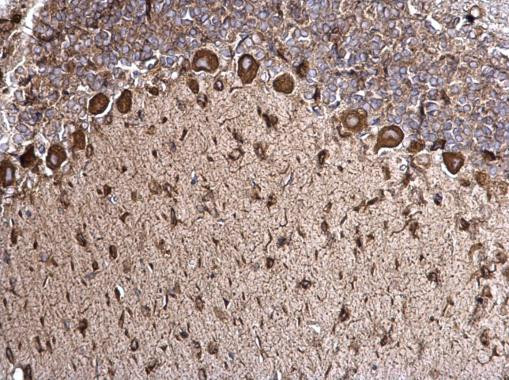 GRP78 Antibody in Immunohistochemistry (Paraffin) (IHC (P))