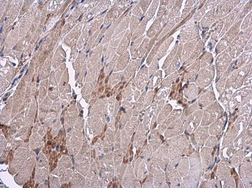 VEGF Antibody in Immunohistochemistry (Paraffin) (IHC (P))