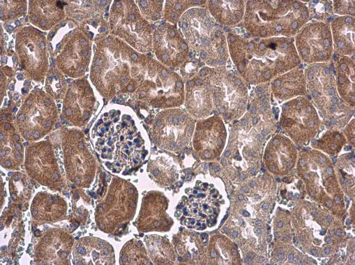 VEGF Antibody in Immunohistochemistry (Paraffin) (IHC (P))