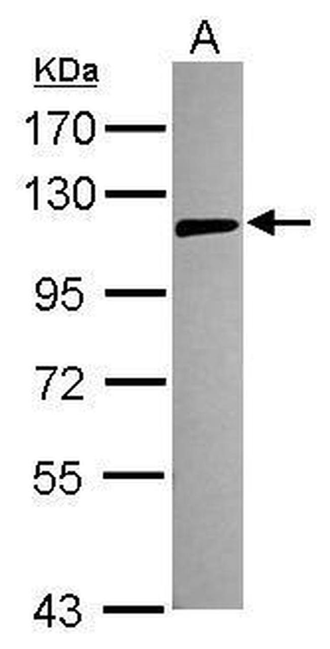 TLR5 Antibody in Western Blot (WB)