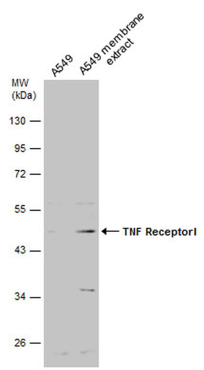 TNFR1 Antibody in Western Blot (WB)