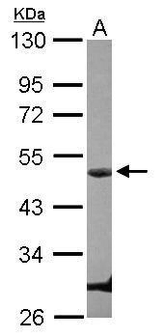 Cyclin E Antibody in Western Blot (WB)