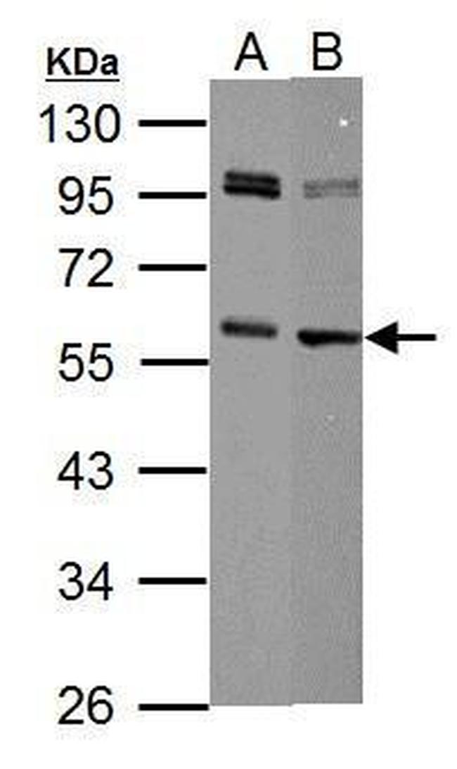 c-Myc Antibody in Western Blot (WB)