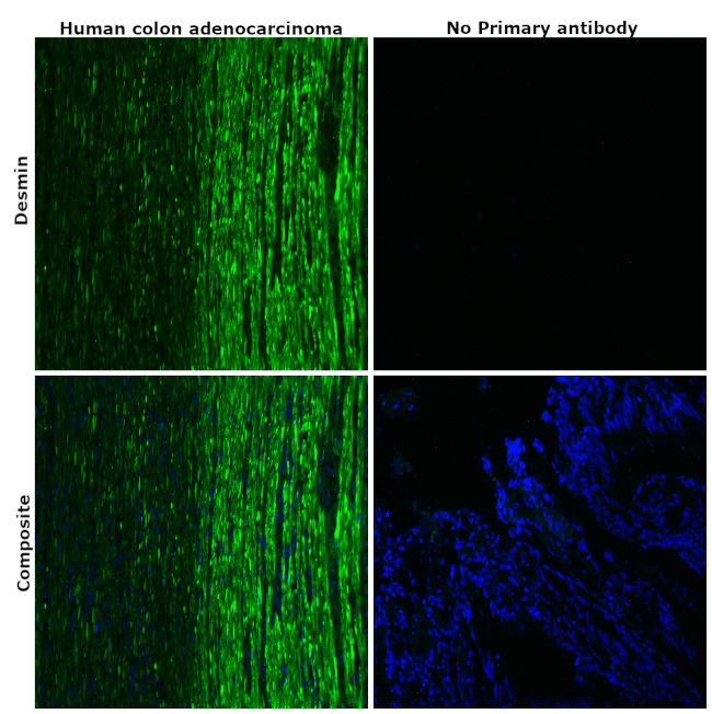 Desmin Antibody in Immunohistochemistry (Paraffin) (IHC (P))