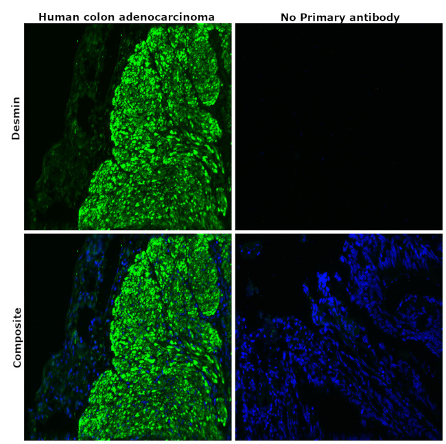 Desmin Antibody in Immunohistochemistry (Paraffin) (IHC (P))