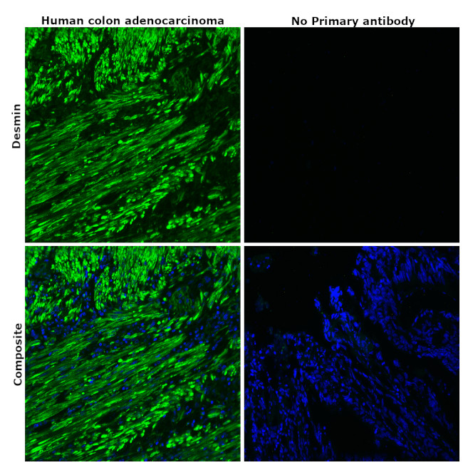 Desmin Antibody in Immunohistochemistry (Paraffin) (IHC (P))