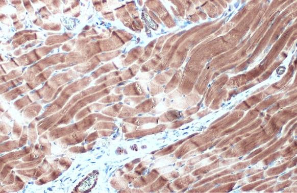 Desmin Antibody in Immunohistochemistry (Paraffin) (IHC (P))