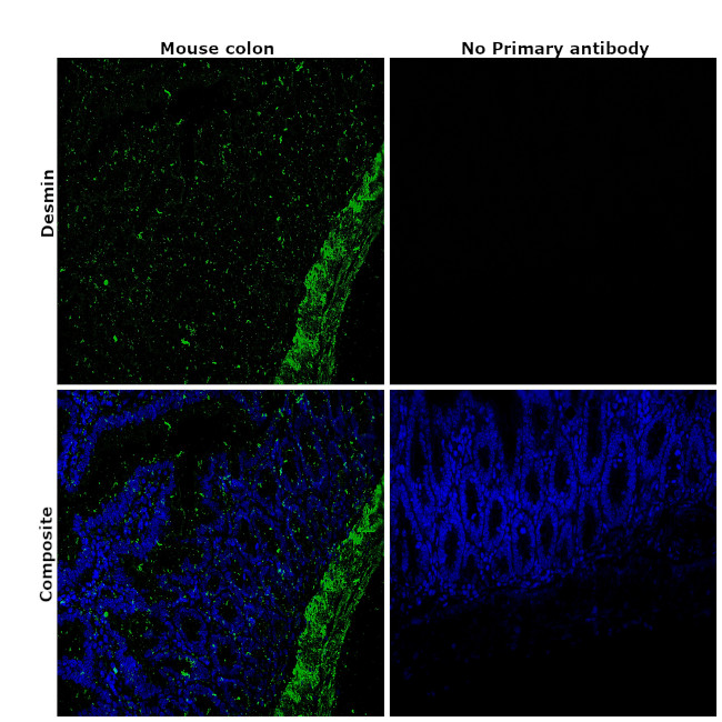 Desmin Antibody in Immunohistochemistry (Paraffin) (IHC (P))