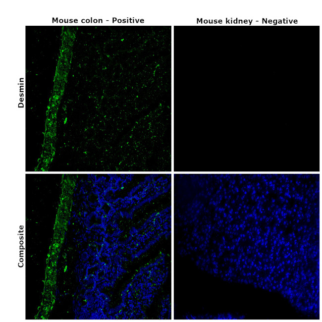 Desmin Antibody in Immunohistochemistry (Paraffin) (IHC (P))