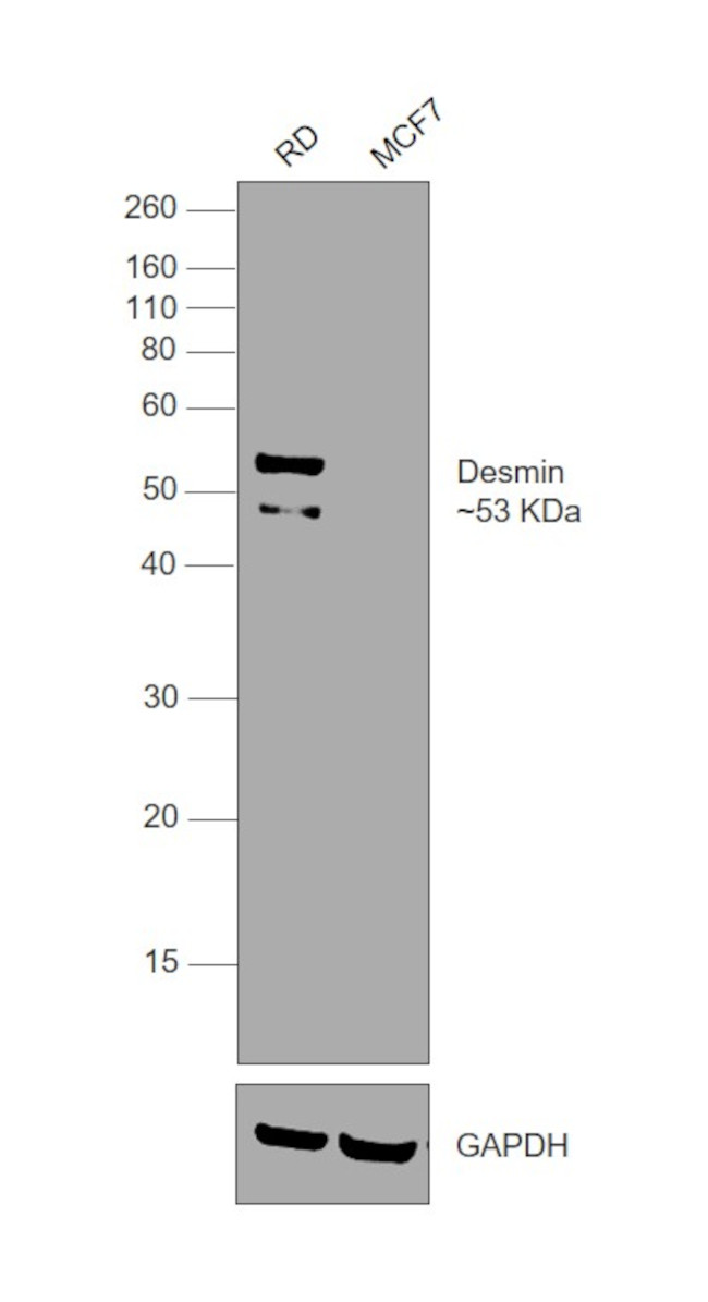 Desmin Antibody in Western Blot (WB)