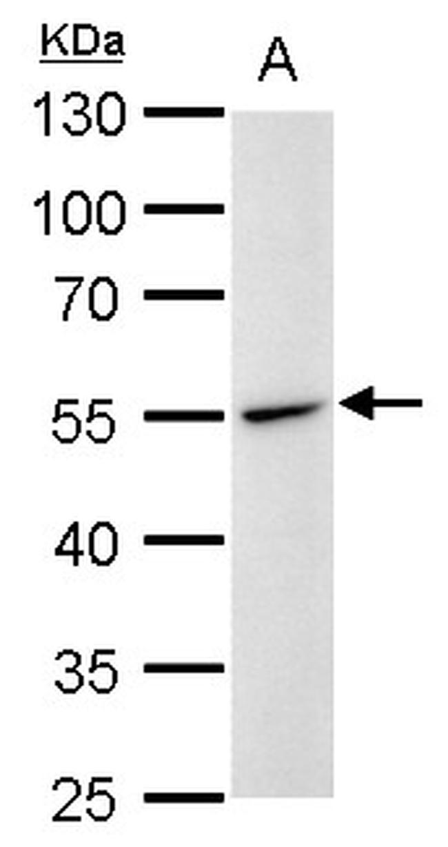 Desmin Antibody in Western Blot (WB)