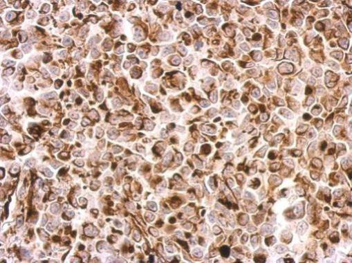 Desmin Antibody in Immunohistochemistry (Paraffin) (IHC (P))