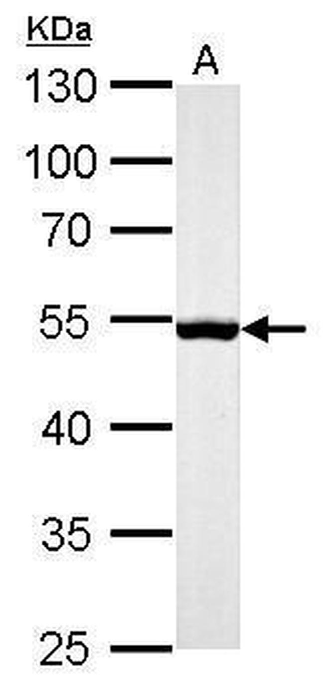 Desmin Antibody in Western Blot (WB)