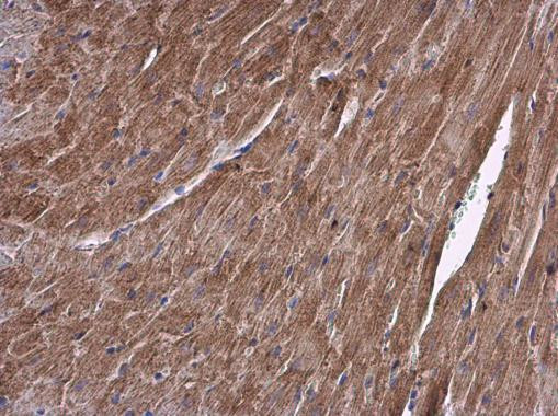 ALDH7A1 Antibody in Immunohistochemistry (Paraffin) (IHC (P))