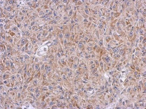 ALDH7A1 Antibody in Immunohistochemistry (Paraffin) (IHC (P))